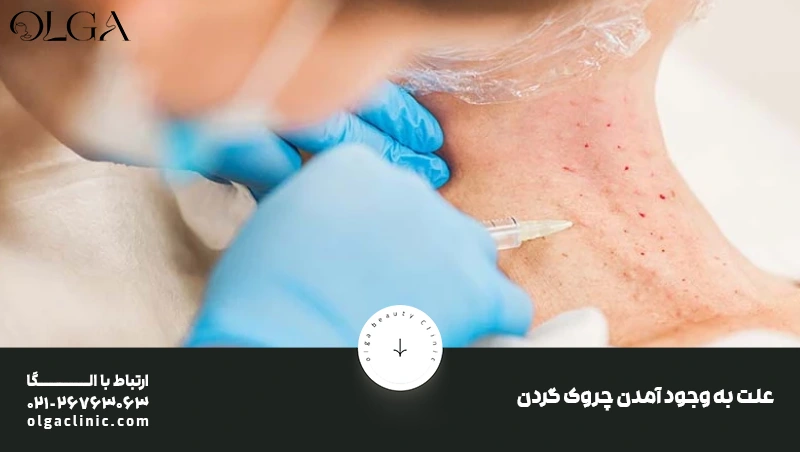 بهترین روغن برای چروک گردن و جوانسازی طبیعی پوست